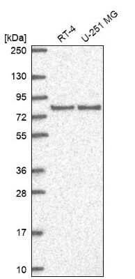 Western Blot: SAP102 Antibody [NBP2-58864]