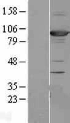 Western Blot: SAP102 Overexpression Lysate [NBL1-09910]