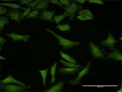 Immunocytochemistry/ Immunofluorescence: SAP130 Antibody (2F1) [H00023450-M03]