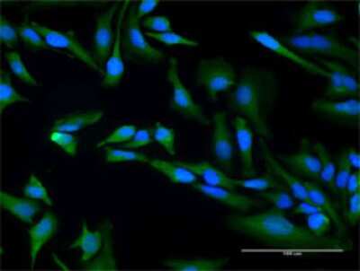 Immunocytochemistry/ Immunofluorescence: SAP130 Antibody (2F1) [H00023450-M03]