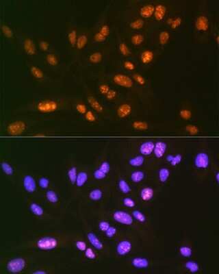 Immunocytochemistry/ Immunofluorescence: SAP130 Antibody (3K1X4) [NBP3-16842]