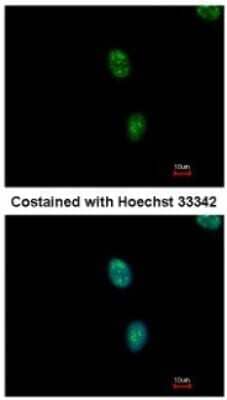 Immunocytochemistry/ Immunofluorescence: SAP130 Antibody [NBP1-31281]