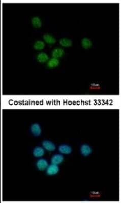 Immunocytochemistry/ Immunofluorescence: SAP130 Antibody [NBP2-20258]