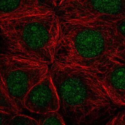 Immunocytochemistry/ Immunofluorescence: SAP130 Antibody [NBP2-58943]