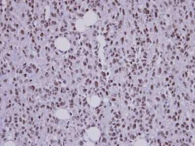 Immunohistochemistry-Paraffin: SAP130 Antibody [NBP1-31281]