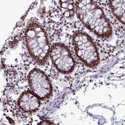 Immunohistochemistry-Paraffin: SAP130 Antibody [NBP1-92362]