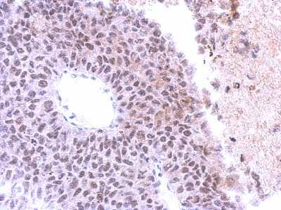 Immunohistochemistry-Paraffin: SAP130 Antibody [NBP2-20258]