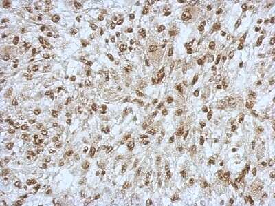 Immunohistochemistry-Paraffin: SAP130 Antibody [NBP2-20259]