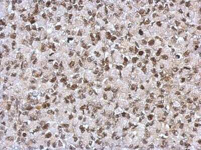 Immunohistochemistry-Paraffin: SAP130 Antibody [NBP2-20259]