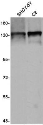 Western Blot: SAP130 Antibody (S07-2K8) [NBP3-19974]