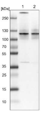 Western Blot: SAP130 Antibody [NBP1-92362]