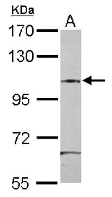 Western Blot: SAP130 Antibody [NBP2-20258]