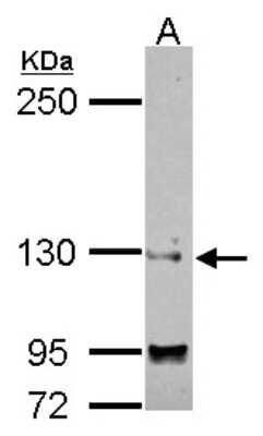 Western Blot: SAP130 Antibody [NBP2-20259]