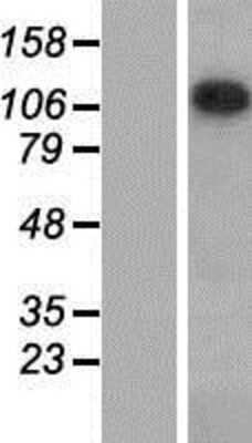 Western Blot: Sin3A-associated protein Overexpression Lysate [NBP2-06320]