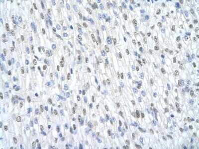 Immunohistochemistry: SAP155 Antibody [NBP1-57192]