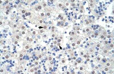 Immunohistochemistry-Paraffin: SAP155 Antibody [NBP1-57192]