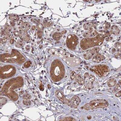 Immunohistochemistry-Paraffin: SAP155 Antibody [NBP2-47291]