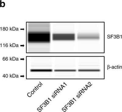 Knockdown Validated: SAP155 Antibody [NB100-55255]