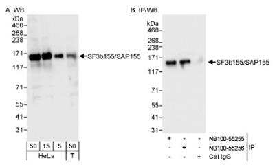 Western Blot: SAP155 Antibody [NB100-55255]