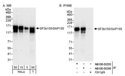 Western Blot: SAP155 Antibody [NB100-55256]