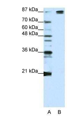 Western Blot: SAP155 Antibody [NBP1-57192]