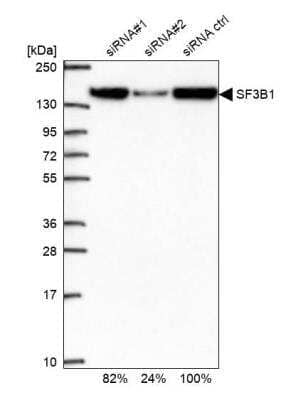 Western Blot: SAP155 Antibody [NBP2-47291]