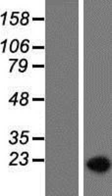 Western Blot: SAP155 Overexpression Lysate [NBP2-10754]