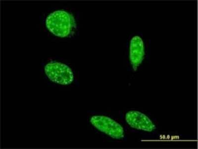 Immunocytochemistry/ Immunofluorescence: SAP18 Antibody (3B2) [H00010284-M01]