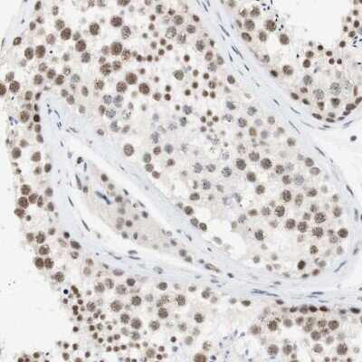 Immunohistochemistry-Paraffin: SAP18 Antibody [NBP1-89385]