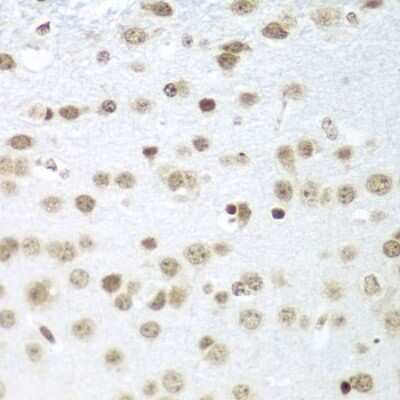 Immunohistochemistry-Paraffin: SAP18 Antibody - BSA Free [NBP2-94893]