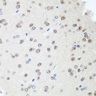 Immunohistochemistry-Paraffin: SAP18 Antibody - BSA Free [NBP2-94893]
