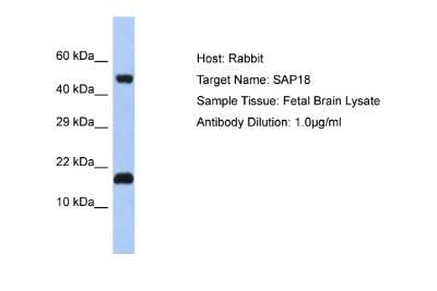 Western Blot: SAP18 Antibody [NBP2-88211]