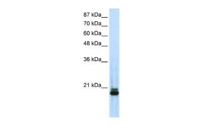 Western Blot: SAP18 Antibody [NBP2-88212]