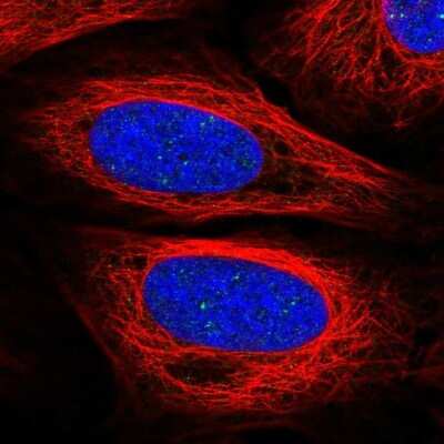 Immunocytochemistry/ Immunofluorescence: SAP25 Antibody [NBP2-32365]