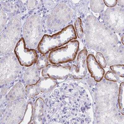 Immunohistochemistry-Paraffin: SAP25 Antibody [NBP2-32365]