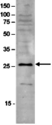 Western Blot: SAP30 Antibody [NBP3-18645]