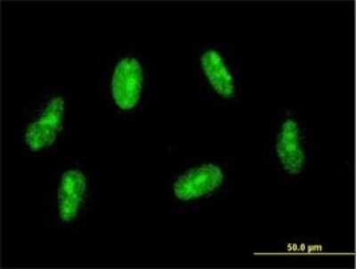 Immunocytochemistry/ Immunofluorescence: SAP30 Antibody (4D2) [H00008819-M02]