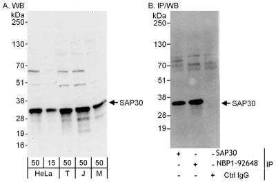 Immunoprecipitation: SAP30 Antibody [NBP1-92648]