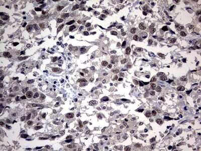 Immunohistochemistry: SAP30BP Antibody (OTI4H1) [NBP2-45686]