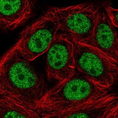 Immunocytochemistry/ Immunofluorescence: SAP30BP Antibody [NBP2-38685]