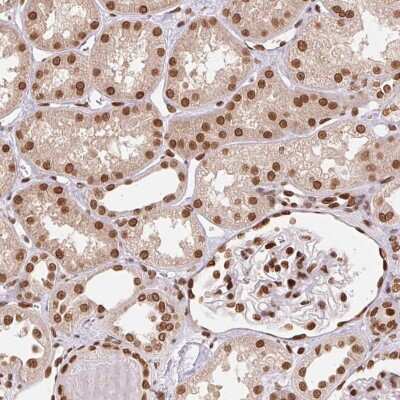 Immunohistochemistry: SAP30BP Antibody [NBP2-38685]