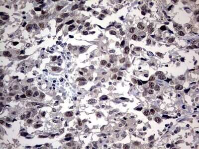Immunohistochemistry: SAP30BP Antibody (OTI4H1) - Azide and BSA Free [NBP2-73987]