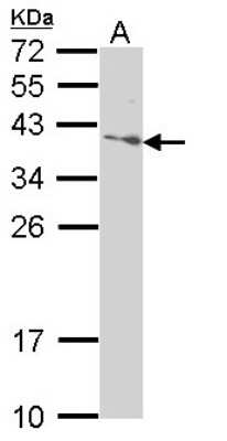 Western Blot: SAP30BP Antibody [NBP1-31695]