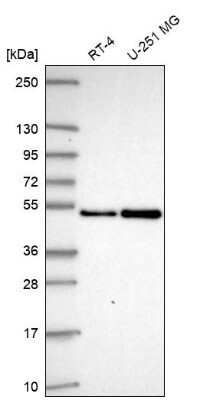 Western Blot: SAP30BP Antibody [NBP2-38685]