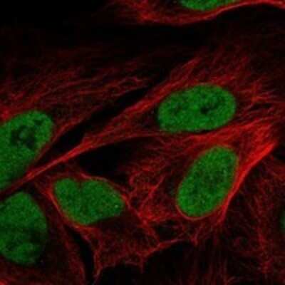 Immunocytochemistry/ Immunofluorescence: SAP30L Antibody [NBP3-17535]