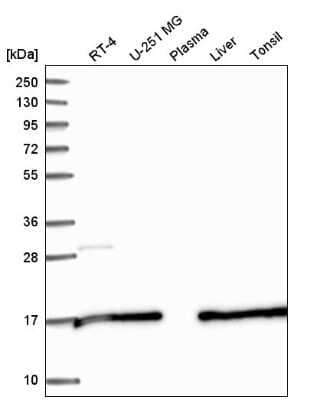 Western Blot: SAP30L Antibody [NBP2-58296]