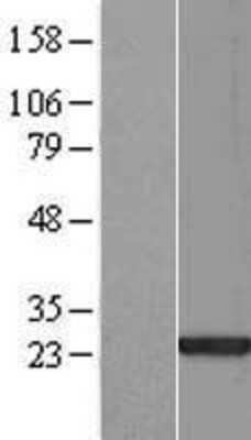 Western Blot: SAP30L Overexpression Lysate [NBL1-15687]