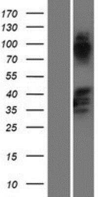 Western Blot: SAPCD2 Overexpression Lysate [NBP2-10230]