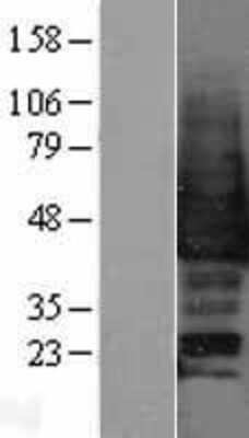 Western Blot: p38 gamma/SAPK3 Overexpression Lysate [NBP2-04236]