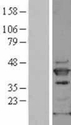 Western Blot: p38 delta/SAPK4 Overexpression Lysate [NBL1-12872]